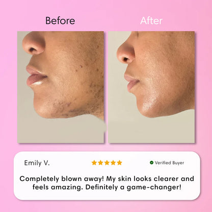 JEREMYTIS™ Instant Hair Removal Kit