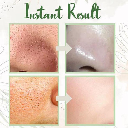 （🔥LAST DAY SALE-60% OFF + Includes a complimentary brush)Final Sale -Herbal Deep Cleansing Mask