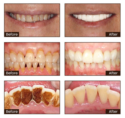 🔥[Official Brand Store] ODALIT™ Niacinamide Intensive Whitening Toothpaste