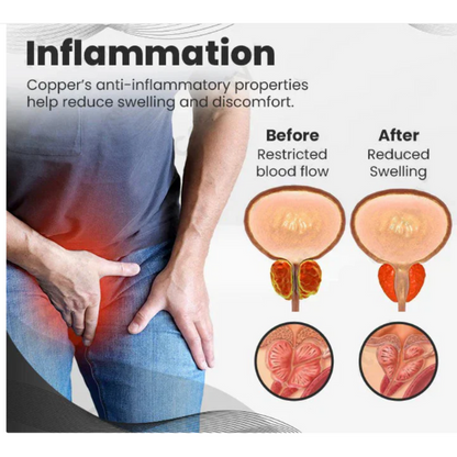 Anti Snoring Device Ring Magnetic Therapy Acupressure Treatment Against Finger Ring Anti Snore Sleep