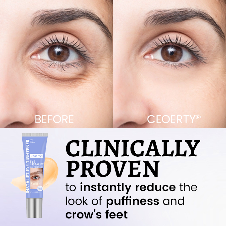 Eye Tightener – 10 Seconds to Younger, Fresher Eyes