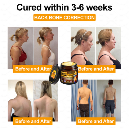 ✅Official Store: Bee-Venom Pain-Relief Bone Healing Cream✅( BOA Approved)(🔥𝑳𝒂𝒔𝒕 𝒅𝒂𝒚 𝒑𝒓𝒐𝒎𝒐𝒕𝒊𝒐𝒏 80% 𝒐𝒇𝒇)🍀