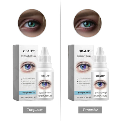 [Official Brand Store] ODALIT® EyeCandy Drops (✨BUY 1 GET 1 FREE🎁)