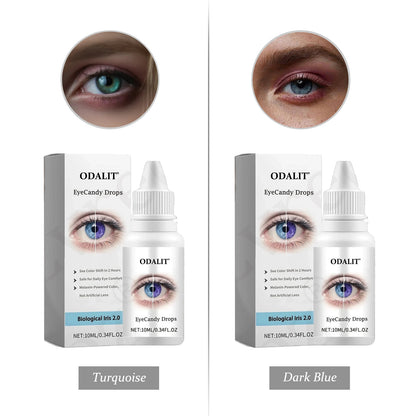 [Official Brand Store] ODALIT® EyeCandy Drops (✨BUY 1 GET 1 FREE🎁)