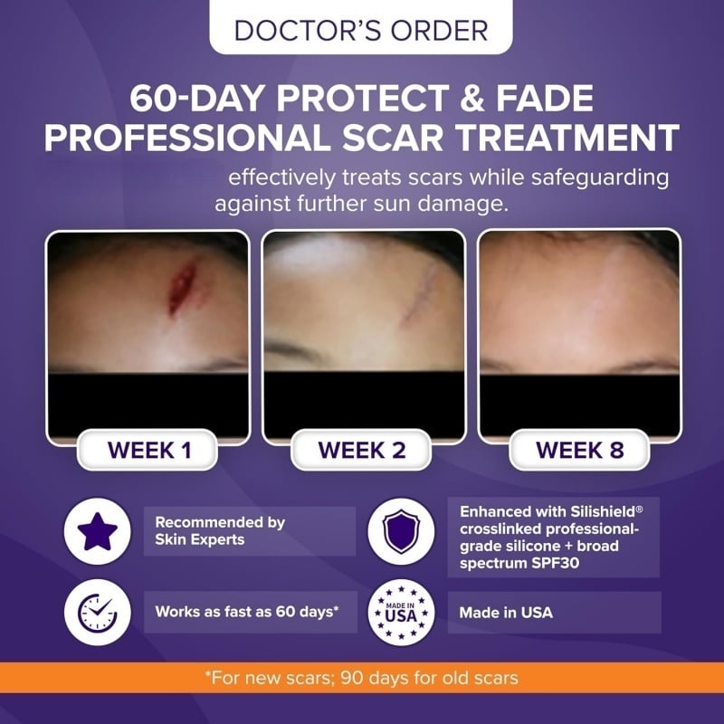 Skin Scar Solutions🛡️ 60%  Silicone Scar Stick