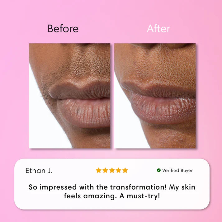 JEREMYTIS™ Instant Hair Removal Kit