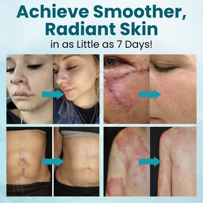 🌟 Official Store | Advanced Scar Gel – Reveal Smooth, Healthier Skin Fast!✨