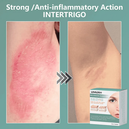 🔥Final 3 Hours -  Magnesium MicroNeedle Quick Remove Skin Tag Patches