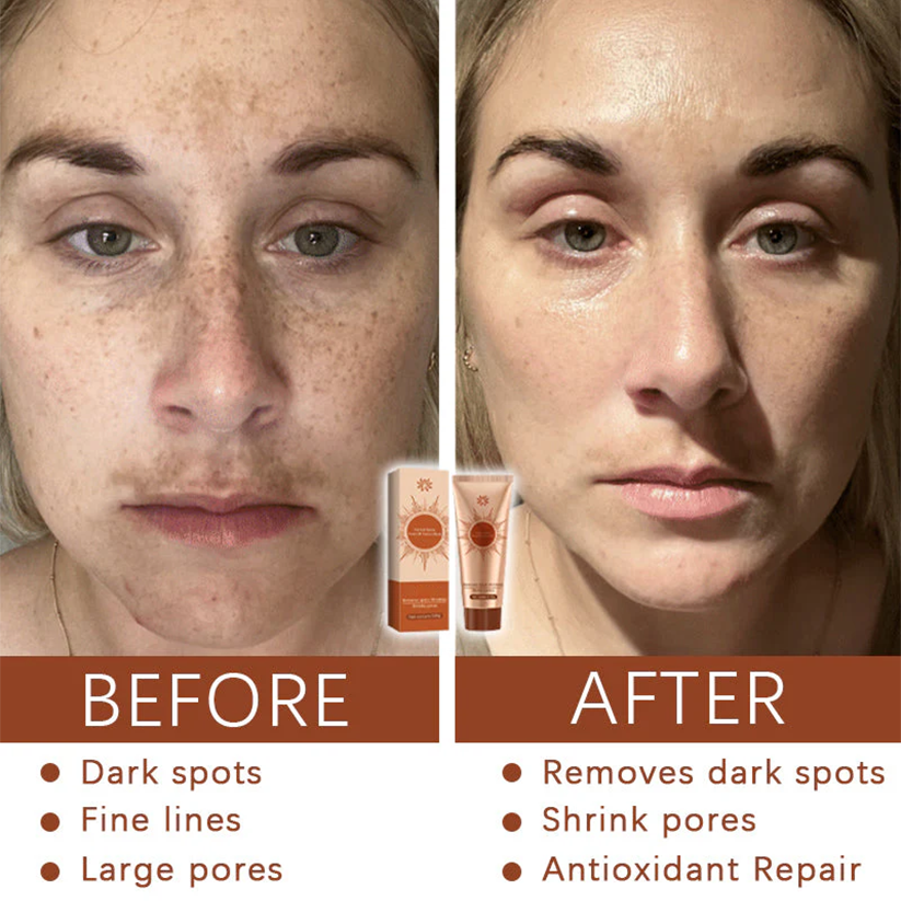 🔥BUY 3 GET 1 FREE+Free Shipping!📦Herbal Spots Peel-Off Facial Mask