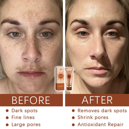 🔥BUY 3 GET 1 FREE+Free Shipping!📦Herbal Spots Peel-Off Facial Mask