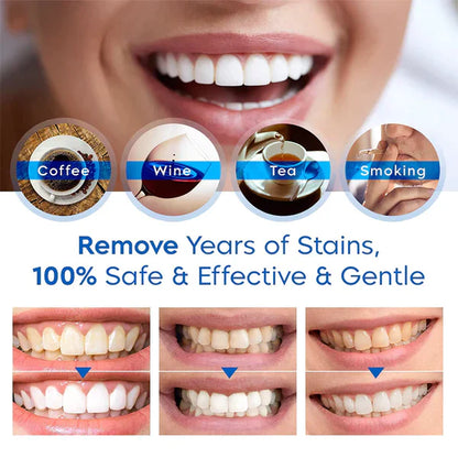 ✨[Official Brand Store] Teeth Whitening Essence Pen (🎁BUY 2 GET 1 FREE🎁)