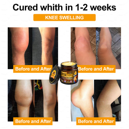 ✅Official Store: Bee-Venom Pain-Relief Bone Healing Cream✅( BOA Approved)(🔥𝑳𝒂𝒔𝒕 𝒅𝒂𝒚 𝒑𝒓𝒐𝒎𝒐𝒕𝒊𝒐𝒏 80% 𝒐𝒇𝒇)🍀