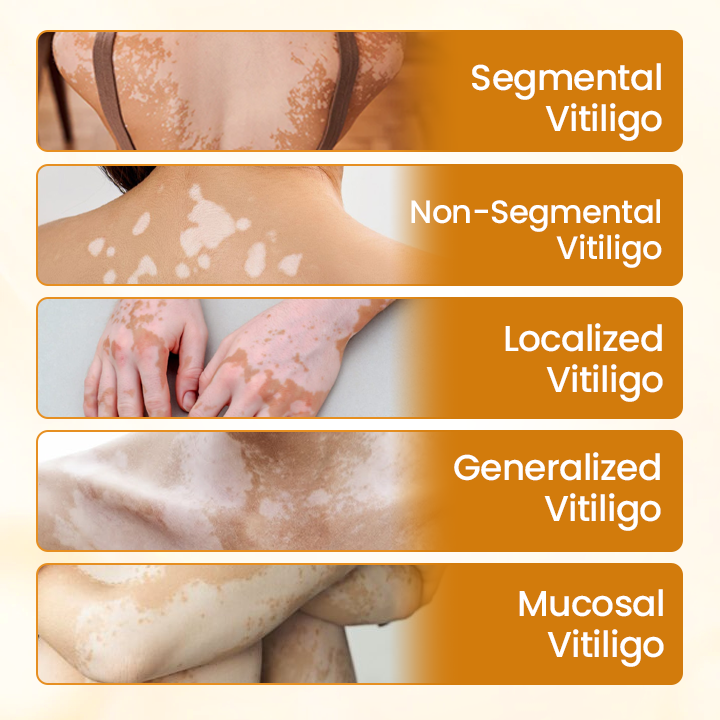 Final 3 Hours:50% OFF🔥【Official Flagship Store】 VitiClear Pro Bee Toxin Cream