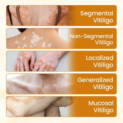 Final 3 Hours:50% OFF🔥【Official Flagship Store】 VitiClear Pro Bee Toxin Cream