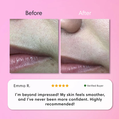 JEREMYTIS™ Instant Hair Removal Kit