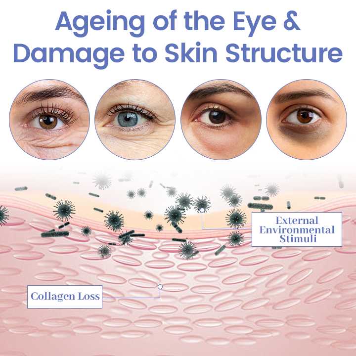 Eye Tightener – 10 Seconds to Younger, Fresher Eyes