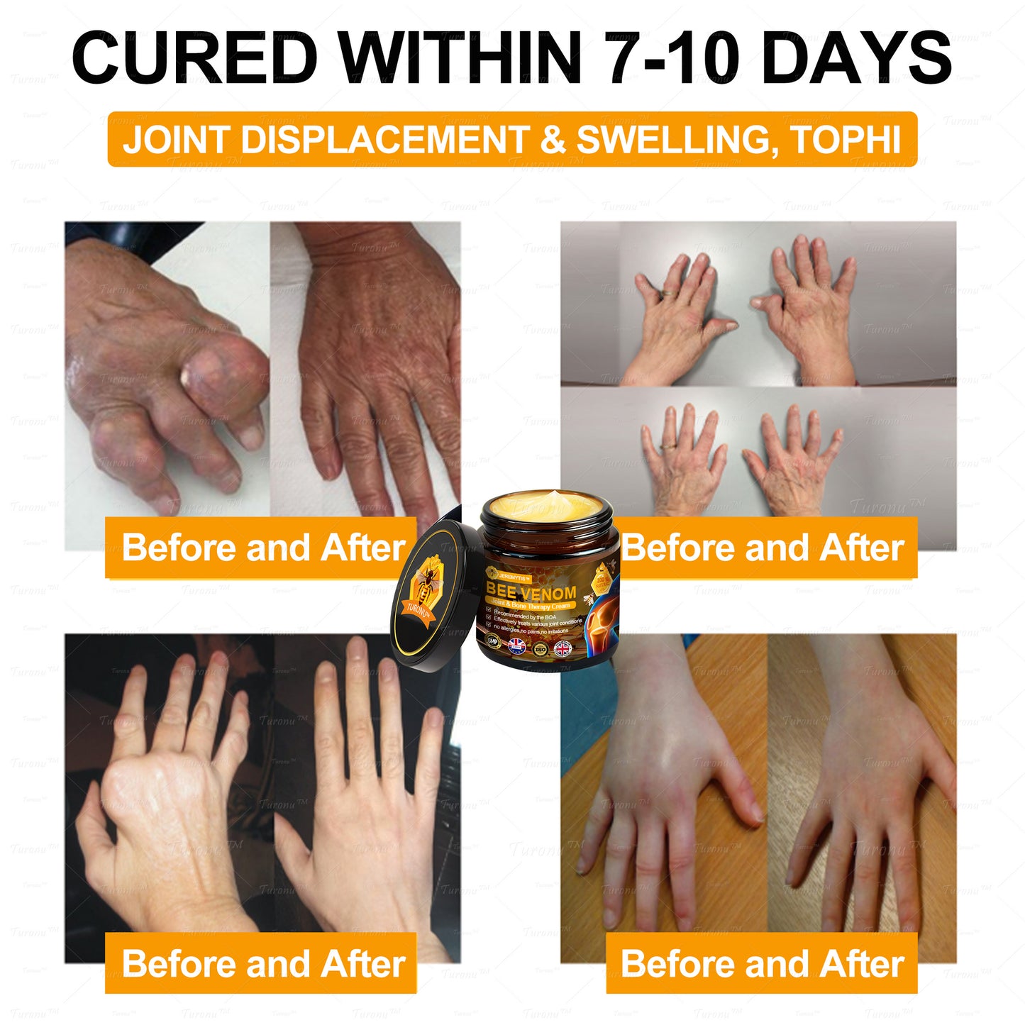 ✅Official Store: Bee-Venom Pain-Relief Bone Healing Cream✅( BOA Approved)(🔥𝑳𝒂𝒔𝒕 𝒅𝒂𝒚 𝒑𝒓𝒐𝒎𝒐𝒕𝒊𝒐𝒏 80% 𝒐𝒇𝒇)🍀