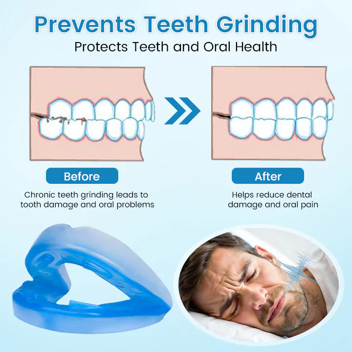 🔥[Official Brand Store] JEREMYTIS™ Adjustable Anti-Snoring Mouthpiece  Universal Size