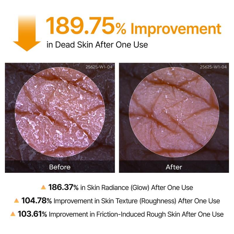 🌟Peel Shot Keratin Care Kojic Acid Turmeric Spray