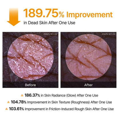 🌟Peel Shot Keratin Care Kojic Acid Turmeric Spray