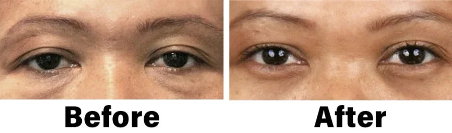Nano Vision Repair Eye Serum ✅FDA Approved(Suitable for presbyopia, dry eye syndrome, glaucoma, and cataracts)