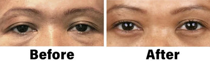 Nano Vision Repair Eye Serum ✅FDA Approved(Suitable for presbyopia, dry eye syndrome, glaucoma, and cataracts)