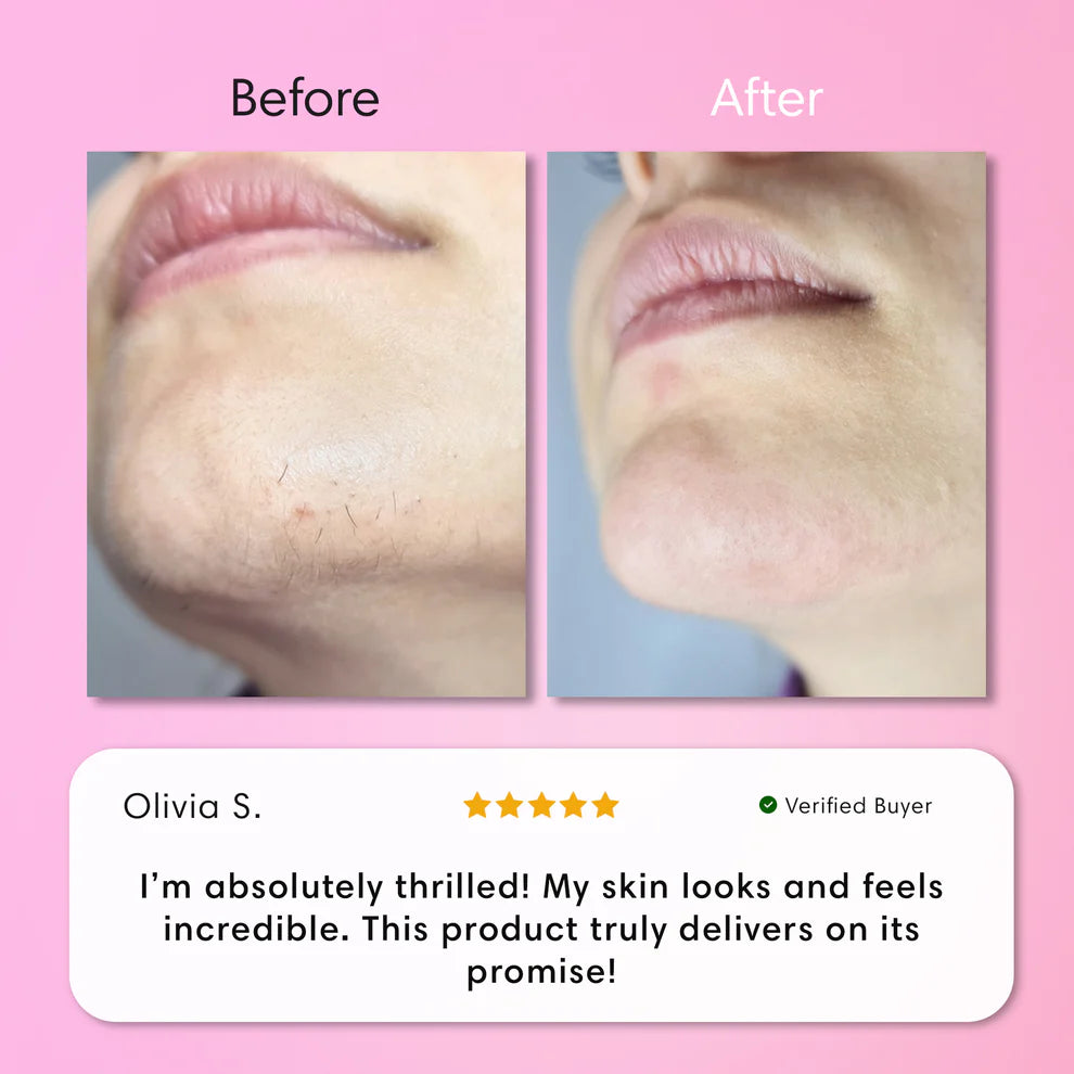 JEREMYTIS™ Instant Hair Removal Kit