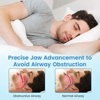 🔥[Official Brand Store] JEREMYTIS™ Adjustable Anti-Snoring Mouthpiece  Universal Size
