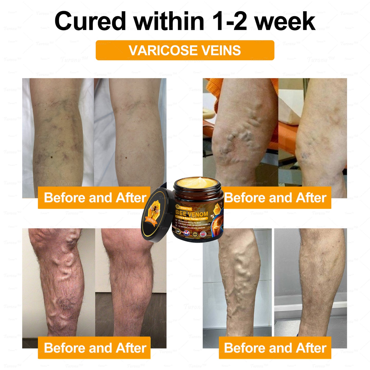 ✅Official Store: Bee-Venom Pain-Relief Bone Healing Cream✅( BOA Approved)(🔥𝑳𝒂𝒔𝒕 𝒅𝒂𝒚 𝒑𝒓𝒐𝒎𝒐𝒕𝒊𝒐𝒏 80% 𝒐𝒇𝒇)🍀
