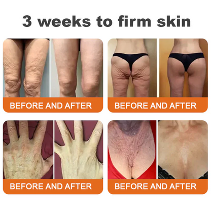 FDA Approved: ODALIT® Bee Venom Skin Restoration Cream — 🔥Limited Time 70% OFF🔥