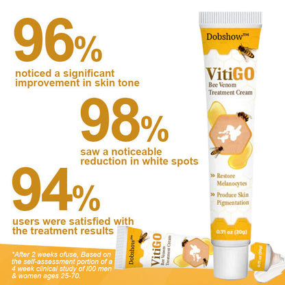 【Official Flagship Store】 Bee Venom Vitiligo Treatment Cream