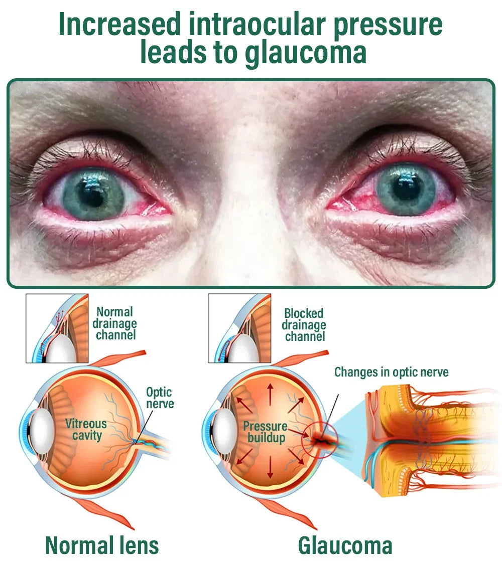 Nano Vision Repair Eye Serum ✅FDA Approved(Suitable for presbyopia, dry eye syndrome, glaucoma, and cataracts)
