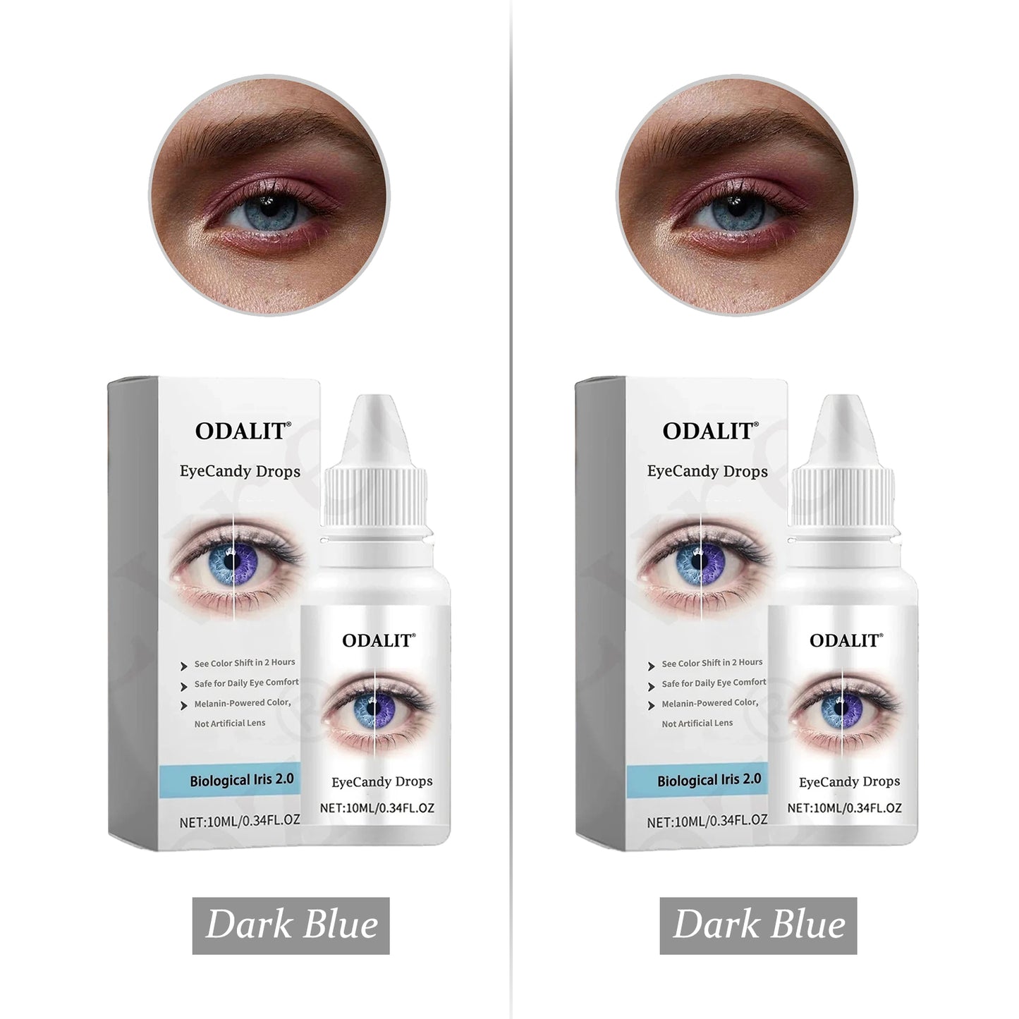 [Official Brand Store] ODALIT® EyeCandy Drops (✨BUY 1 GET 1 FREE🎁)