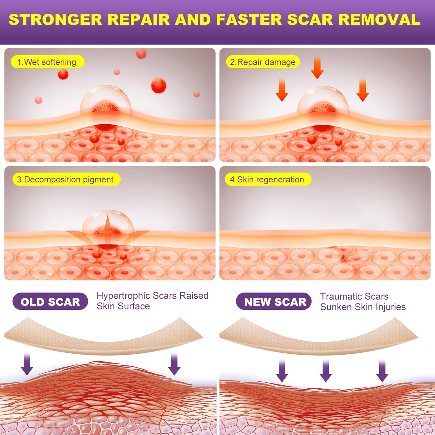 🔥Fade Scars Fast — No Pain, All Gain!🔥
