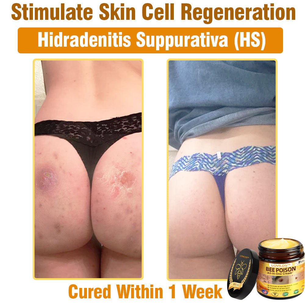 ODALIT™ Bee Poison All-in-One Cream US Dermatologist Approved