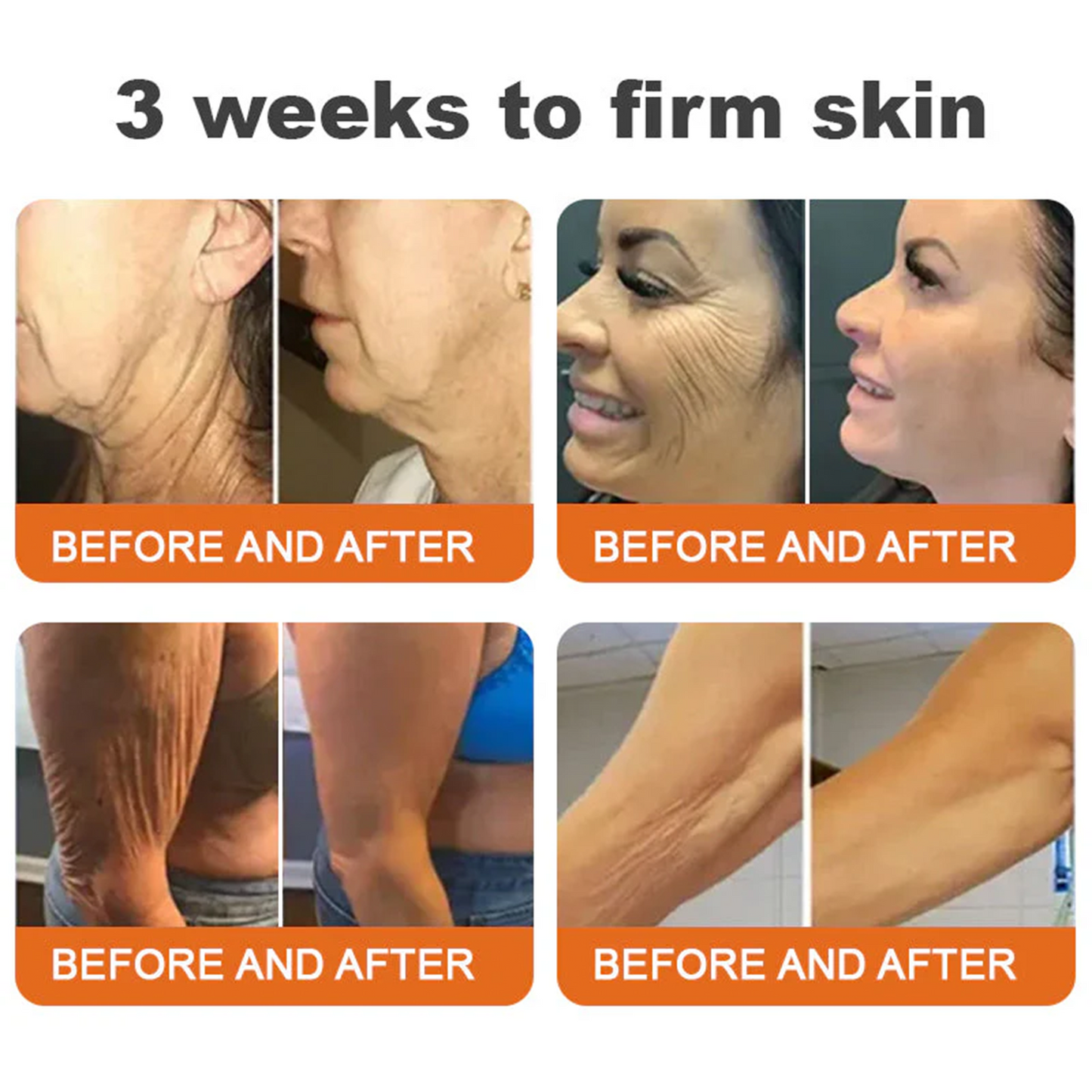 FDA Approved: ODALIT® Bee Venom Skin Restoration Cream — 🔥Limited Time 70% OFF🔥