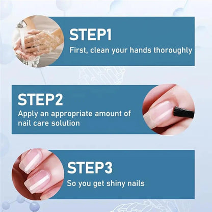 🔥Last Day 49% Buy 1 Get 1 Free🔥 3 Days Nail Care Formula