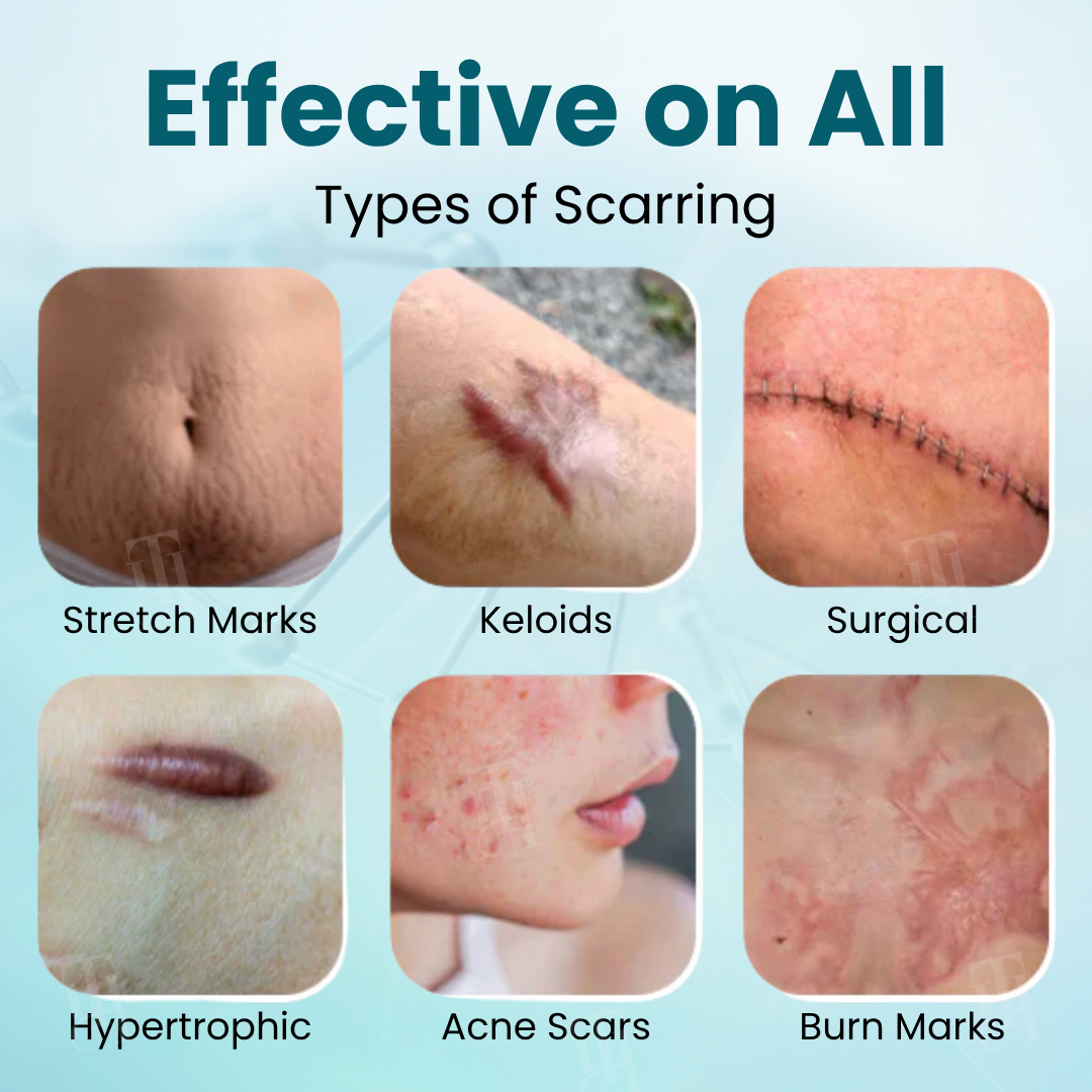 🌟 Official Store | Advanced Scar Gel – Reveal Smooth, Healthier Skin Fast!✨