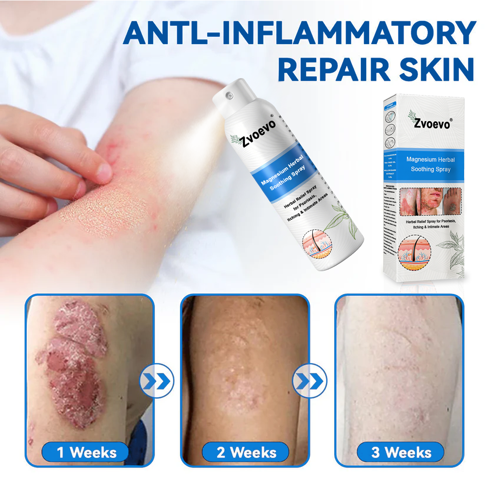 ✅ Official Store: Magnesium Herbal Psoriasis Spray ⚕️