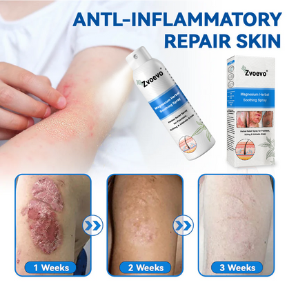 ✅ Official Store: Magnesium Herbal Psoriasis Spray ⚕️