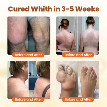 【Official Flagship Store】 Premium Curcumin Pain Relief Gel