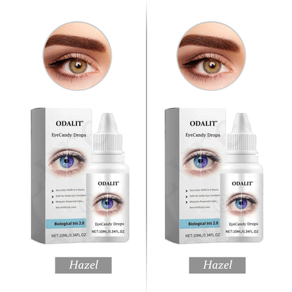 [Official Brand Store] ODALIT® EyeCandy Drops (✨BUY 1 GET 1 FREE🎁)