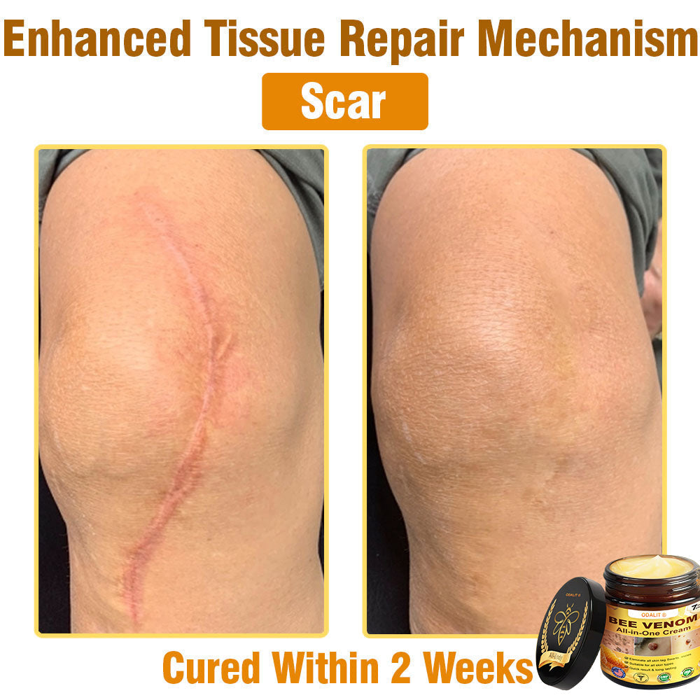 ODALIT™ Bee Poison All-in-One Cream US Dermatologist Approved