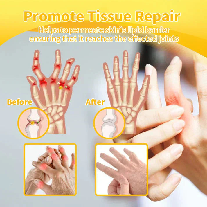🎁✅Official Store BUY 2 GET 1 FREE: flysmus™ Lidocaine Scar-Free Pain Relief Healing Liquid