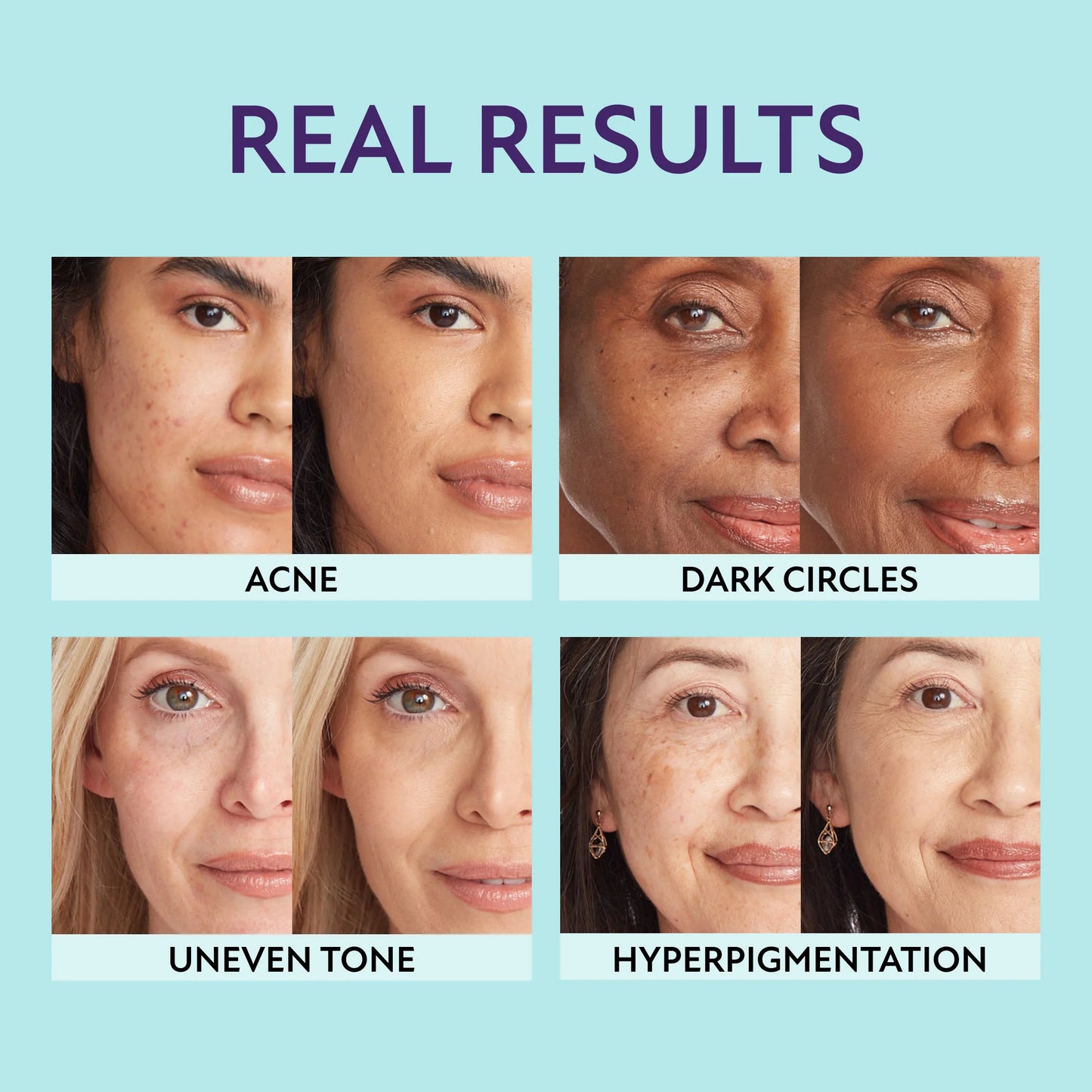JEREMYTIS™ All Over Complexion Perfector