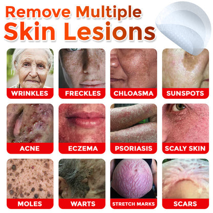 【Official Flagship Store】MicroNeedle Botanic Skin Tag Removal Patch|Made in the USA