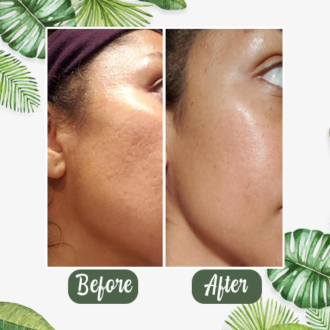 （🔥LAST DAY SALE-60% OFF + Includes a complimentary brush)Final Sale -Herbal Deep Cleansing Mask
