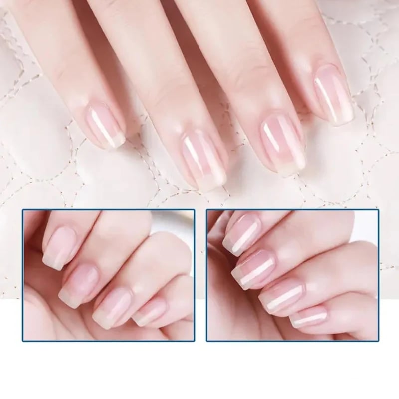 🔥Last Day 49% Buy 1 Get 1 Free🔥 3 Days Nail Care Formula