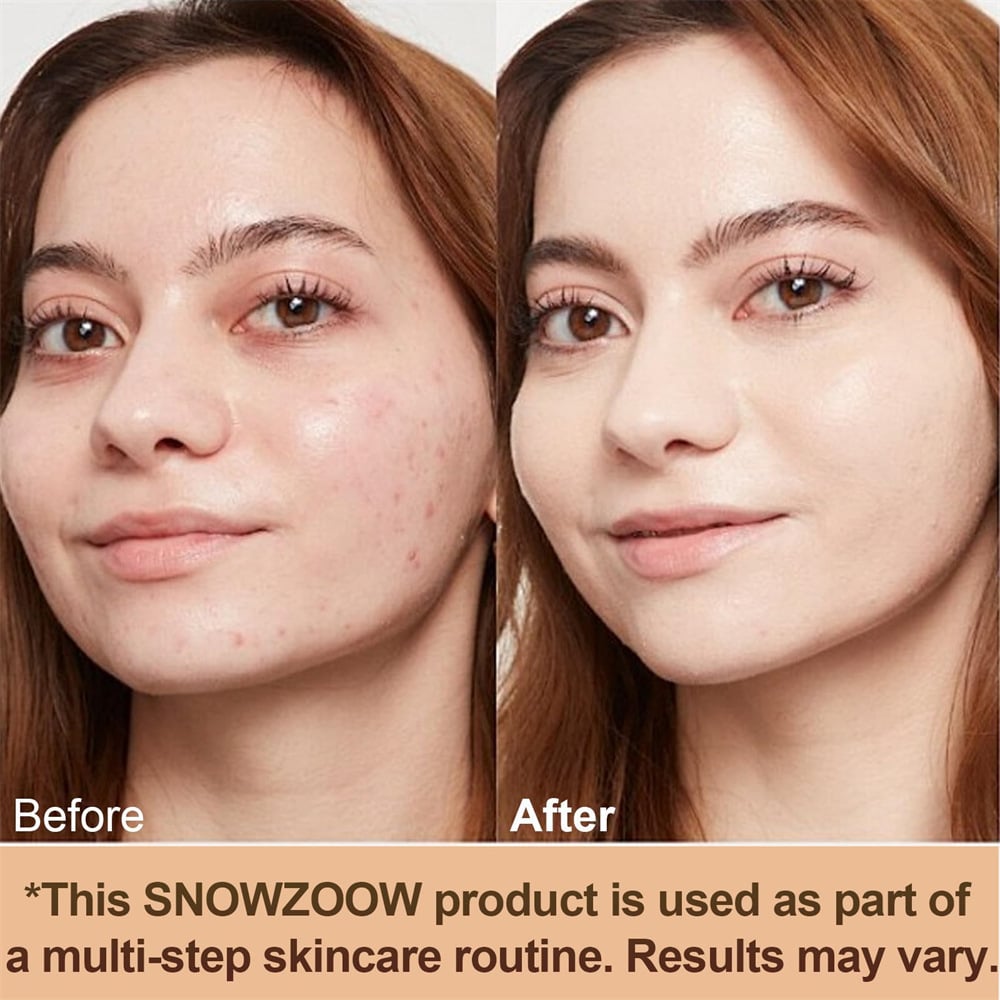 🔥 LAST DAY-49% OFF🔥Concealer for All Skin Types