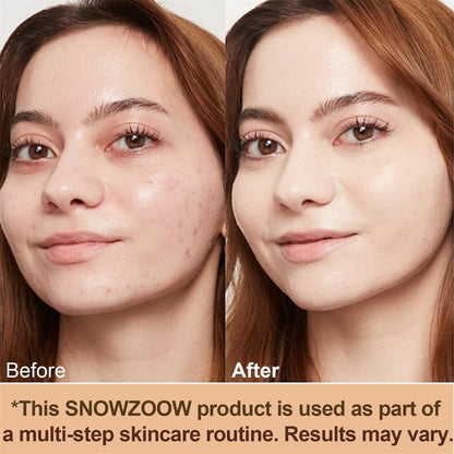 🔥 LAST DAY-49% OFF🔥Concealer for All Skin Types